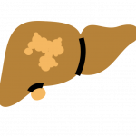 Lifesavers-Liver-1B-cancer